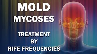 Mold and Mycoses Fungus Diseases  RIFE Frequencies Treatment  Energy amp Quantum Medicine [upl. by Faun]