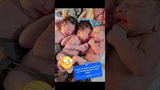 Beautiful Triplets Newborn Babies immediately AfterBirth [upl. by Aillicec]