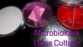 Urine Culture Microbiology Video 2 [upl. by Siegfried]