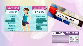 TSH test  Cobas e411  SHILP labs Hypothyroidism HyperthyroidismT3T4Free T3Free T4 [upl. by Glick34]