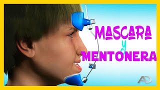 🔺️MENTONERA ortodoncia Y MASCARA FACIAL ortodoncia🔺️PROGNATISMO MANDIBULAR [upl. by Weywadt]