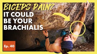 Why the Brachialis Muscle Causes Biceps and Elbow Pain in Climbers [upl. by Pangaro634]