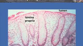 T CellTargeting in Inflammatory Bowel Disease [upl. by Narret]