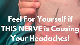 How to Check To See if Your Chronic headache is Coming from an Occipital Nerve Entrapment [upl. by Ephraim]