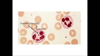 Hematoloji  Eritrosit Hastalıkları Histopatolojisi ve Lökosit Morfolojisi [upl. by Nirtiak]