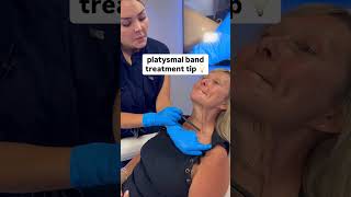 Platysmal band treatment tip [upl. by Pollack]