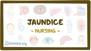 Jaundice Clinical Nursing Care [upl. by Aniakudo]