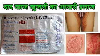 Syntran SB 130 Capsule  Itroconazole 130 Capsule  dad khaj khujli ki dawai  Itroconazole capsule [upl. by Lierbag]