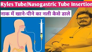 ryles tube insertion nasogastric tube insertion hindi technique NG Tube RT Insertion Dr Satish [upl. by Tnilk981]