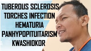 Discussion on Tuberous Sclerosis TORHES Panhypopituitarism Kwashiokor Birth Injury Hematuria [upl. by Ailuig]