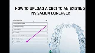 How to Upload a CBCT to an Existing Invisalign Clincheck [upl. by Tennos]