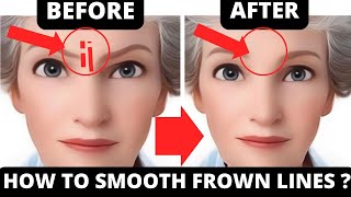 EASY FACIAL EXERCISES TO GET RID OF FROWN LINES WITHOUT BOTOX [upl. by Aisirtap]