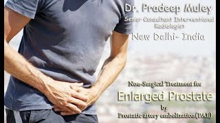 Knowing the Signs of Enlarged Prostate [upl. by Enahs]