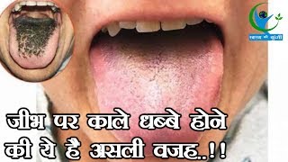 जानिए क्यों हो जाते हैं जीभ पर काले धब्बे वजह जानकर चौंक जाएंगे आप…  Health Tips [upl. by Akeyla523]