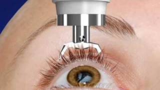 Unique DIATON Tonometry Through Eyelid  with Diaton Tonometer  Introduction  Description Part1 [upl. by Ellinehc]