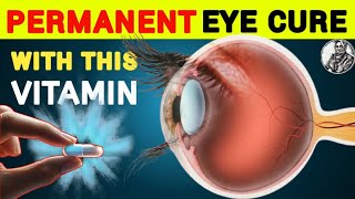 1 Vitamin to Cure Eye Problem Permanently  Eye care Tips  Vitamins eyecare [upl. by Rafe384]