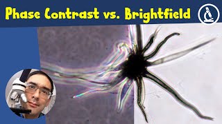 🔬 Brightfield vs Phase Contrast Microscopy Compared  Amateur Microscopy [upl. by Chemush]