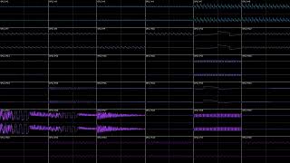 Rei8bit  Anorthosite Field OPL3x2 Cover [upl. by Rambow]