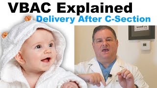 VBACTOLAC Explained Everything about delivery after csection [upl. by Booker]