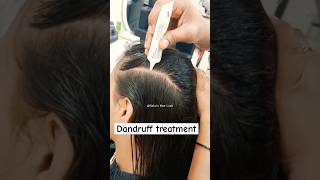 Dandruff treatment results so good✨ shortvideo [upl. by Eartha]