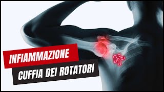 Infiammazione CUFFIA DEI ROTATORI  Come GUARIRE definitivamente [upl. by Longan]