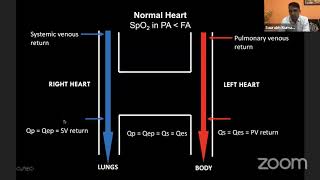 Webinar 1 cyanotic congenital heart disease [upl. by Zitella]