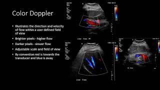 Ultrasound Physics  Types of Doppler Ultrasound [upl. by Naiviv]