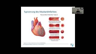 OMI  NOMI  ein Konzept das den myokardialen Schaden reduziert [upl. by Retsevlys]