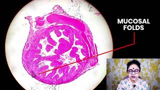 Histology of Uterine Tube Fallopian Tubes  Dr Sibani Mazumder [upl. by Giffy279]