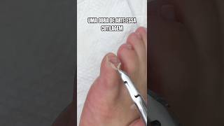 É impressionante como a unha do mindinho do pé tem cutícula 🫠 pedicure unhas manicure pes [upl. by Firehs918]