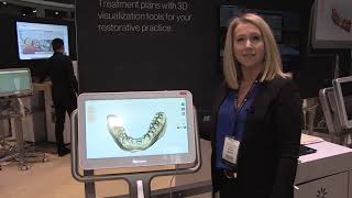 Occlusogram on the iTero Element® 2 Intraoral Scanner [upl. by Teresina]