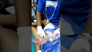 Ultrasound guided suprainguinal fascia iliaca block [upl. by Alesiram]