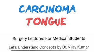 How do we stage oral cancer  TNM Classification and Staging for Oral Cavity Cancers [upl. by Lotsyrk873]