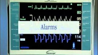 IntraAortic Balloon Catheter Tutorial English [upl. by Reamonn]