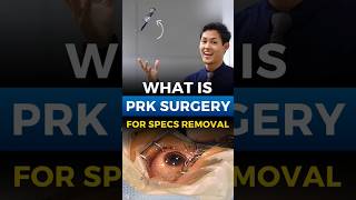 What Is PRK Eye Surgery [upl. by Glad]