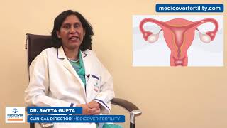 Fallopian Tube Blockage Symptoms Causes Diagnosis and Treatment [upl. by Jann]