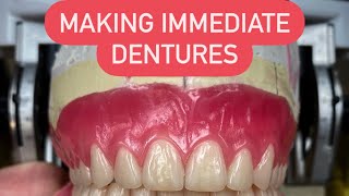 HOW TO MAKE AN IMMEDIATE DENTURES FROM A TO Z waxbae immediatedentures surgicaldentures dentures [upl. by Val]