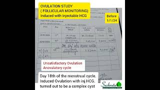 OVULATION STUDY  FOLLICULAR STUDY SATISFACTORY WITH AYURVEDA amp Panchkarma [upl. by Lesli]