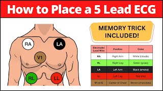 How to Place a 5 Lead ECG MNEMONIC Electrode Placement Made Easy nursing [upl. by Cown]