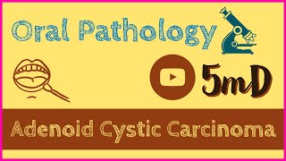 ADENOID CYSTIC CARCINOMA  Salivary gland tumour  Oral Pathology  easy notes [upl. by Mab]