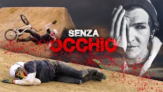 IL MANUBRIO GLI ENTRA IN UN OCCHIO  OSSA DURE Ep1 [upl. by Johen]