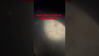 Dog Sperm analysis under microscope [upl. by Brenden]