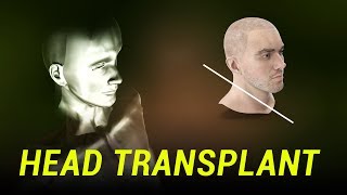 What Happened to the Head Transplant [upl. by Naiva]