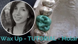 Dental Wax Up Molar 16 InDepth Waxup Tutorial for Dental Study [upl. by Noeled702]