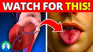 Taste Blood When Coughing  Causes and Treatment [upl. by Tessi]