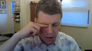 Bells Palsy Eye Closing Exercise [upl. by Nuhsar385]