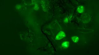 Fluorescence  Acridine Orange vs MitoTracker Green [upl. by Nnaeirelav]