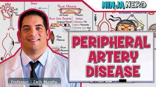 Peripheral Artery Disease  Retired [upl. by Betty]