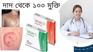 Voricare 200  Fungal infection  Ringwarm  দাদ ফাঙ্গাল ইনফেকশন ও চর্মরোগ থেকে মুক্তির ঔষধ [upl. by Alyos]