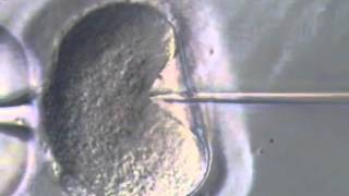 ICSI Intracytoplasmic Sperm Injection in the IVF lab [upl. by Itnahsa377]